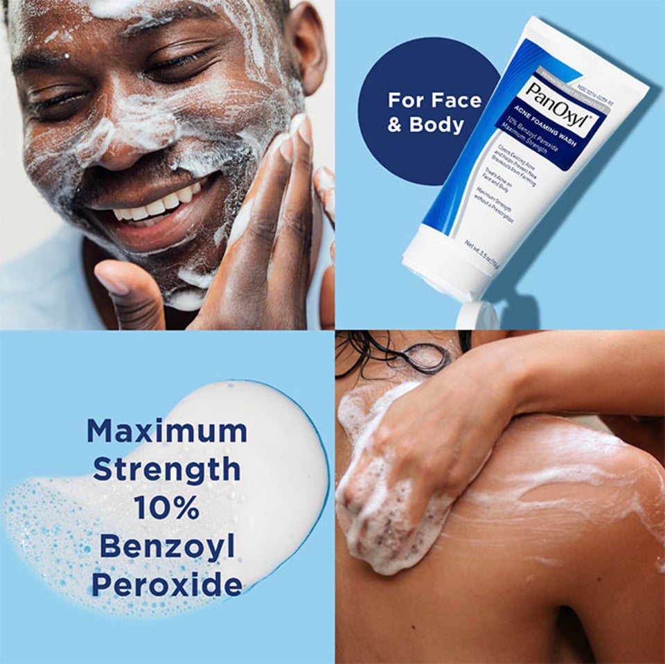 Acne Foaming Wash Benzoyl Peroxide 10% Maximum Strength 156g