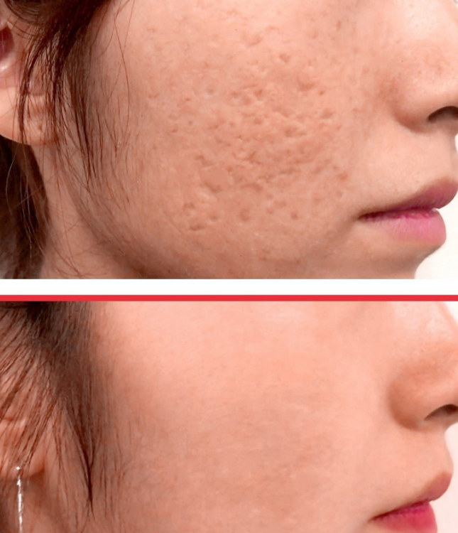 SOME BY MI Snail Truecica Serum + Miracle Foam