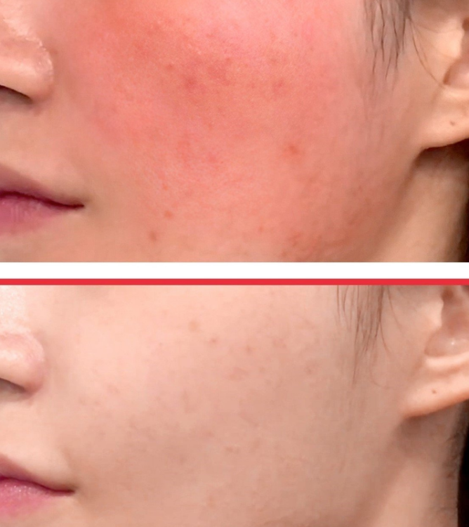 SOME BY MI Snail Truecica Serum + Miracle Foam